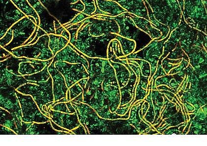 �ϵ���x�Ӿ۱�ϩ����HPAM���a�S��​����ˮ�S�����\�а����Ć��}����̽ӑ��ˮ�S�Č�����n�}�о�